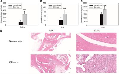 Delanzomib, a Novel Proteasome Inhibitor, Combined With Adalimumab Drastically Ameliorates Collagen-Induced Arthritis in Rats by Improving and Prolonging the Anti-TNF-α Effect of Adalimumab